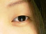 Asian woman with a single eyelid and moderate epicanthal fold, DST, double eyelid surgery,